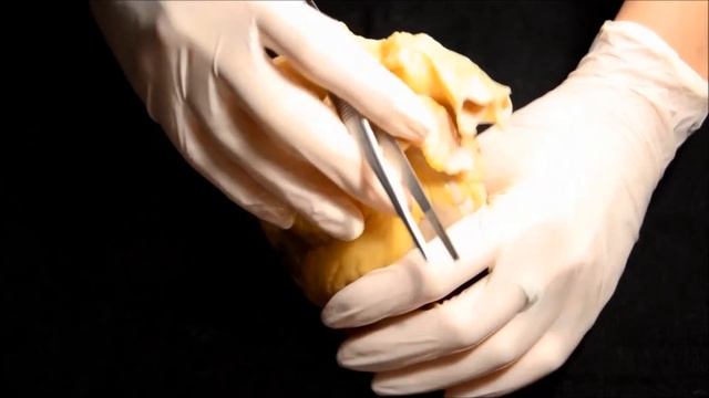 Строение сердца. Внешнее строение. смотреть онлайн