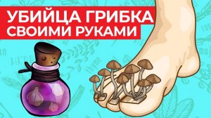 Убираем грибок с ногтей в домашних условиях \ Как вылечить грибок народными средствами?