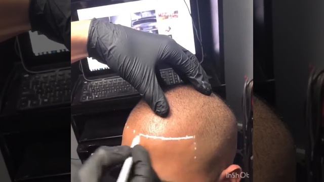 The art of scalp micropigmentation -Daniel Adan [2018] смотреть онлайн