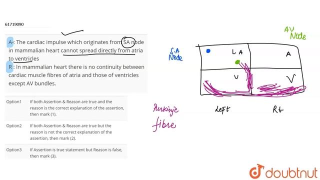 A : The cardiac impulse which originates from SA node in mammalian heart cannot spread смотреть онлайн