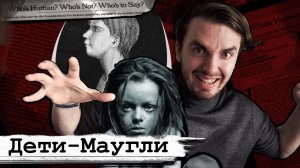 Дети Маугли: Патология которая не лечится - [История Медицины]