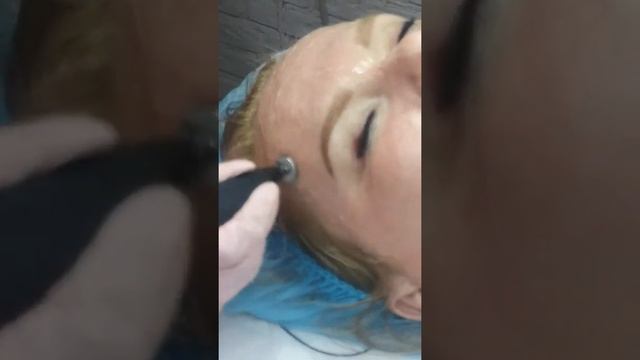 Плазменный холодный душ. Светлана Яковенко Оренбург #косметологияоренбург смотреть онлайн