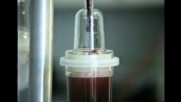 Поликистоз печени © polycystic liver