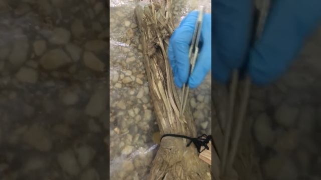 Мышцы плечевого пояса, плеча, предплечья смотреть онлайн