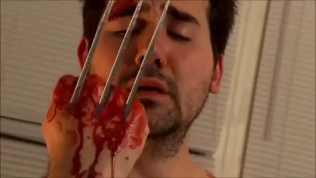 Когти Росомахи - лажа / Wolverine's Claws Suck (rus) смотреть онлайн