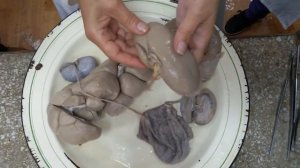 Анатомия почек, мочеточников