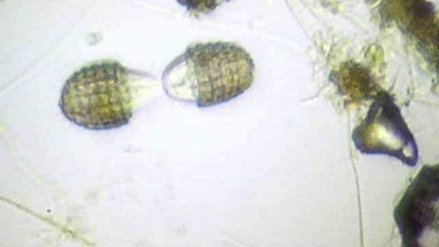 Ciliate division. Деление инфузории. смотреть онлайн