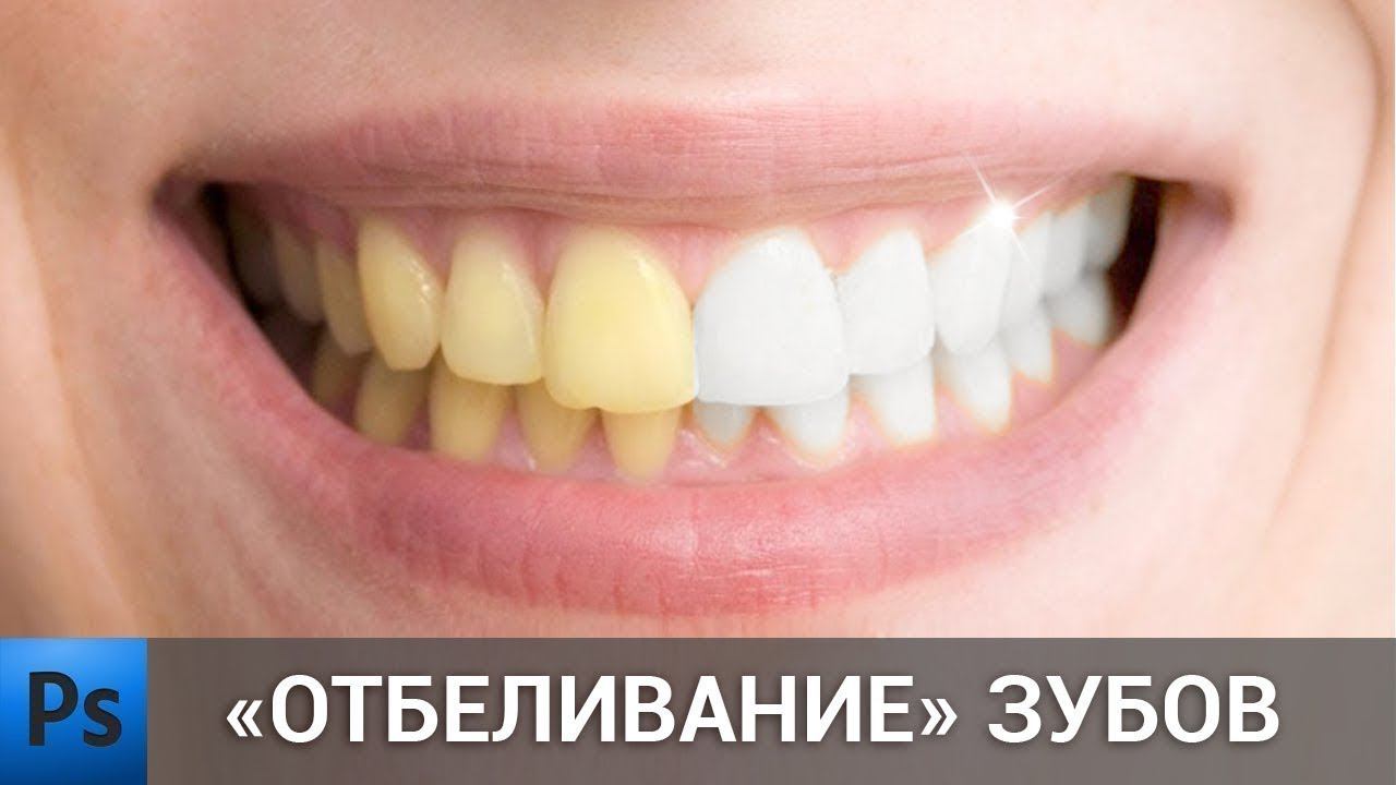 Как сделать отбеливание зубов в фотошопе | Teeth whitening in Photoshop смотреть онлайн