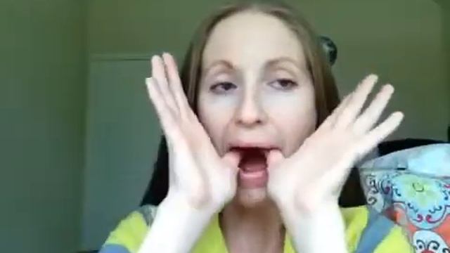 Носогубные складки Как избавиться от носогубных складок