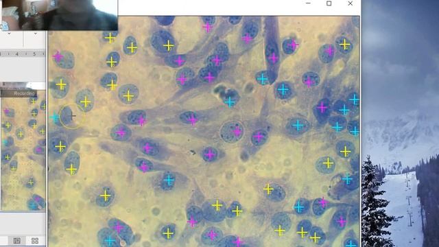 Morphology analysis using Image J смотреть онлайн