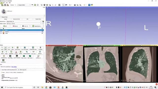 Airway segmentation in 3D Slicer with "Grow from Seeds" смотреть онлайн