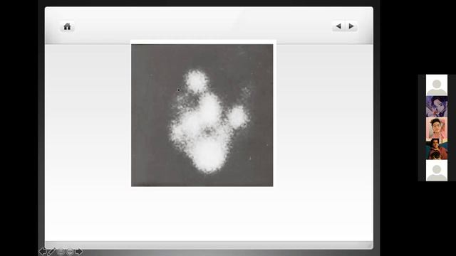 NÓDULO TIROIDEO смотреть онлайн