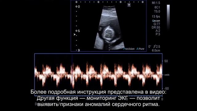 Россиянам стали доступны новые функции на «умных» часах Samsung смотреть онлайн