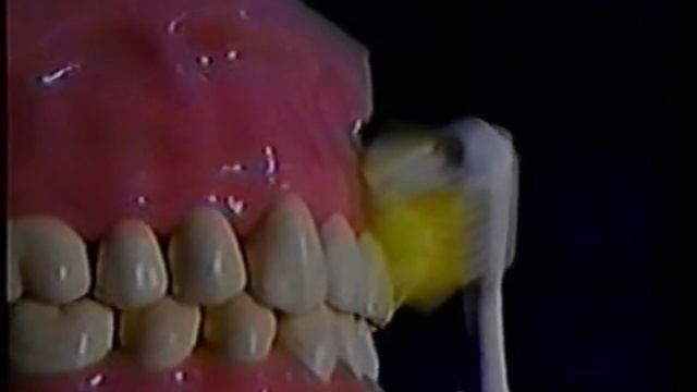 BROXODENT - Broxo Dents & gencives - Comparatif avec Braun - Oral-B смотреть онлайн