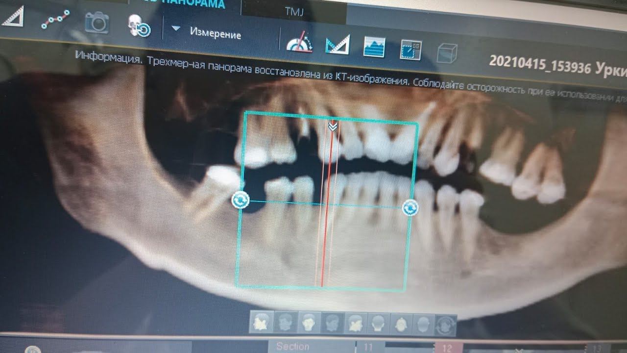 Причины размытости изображения во вьювере Ez3D i смотреть онлайн