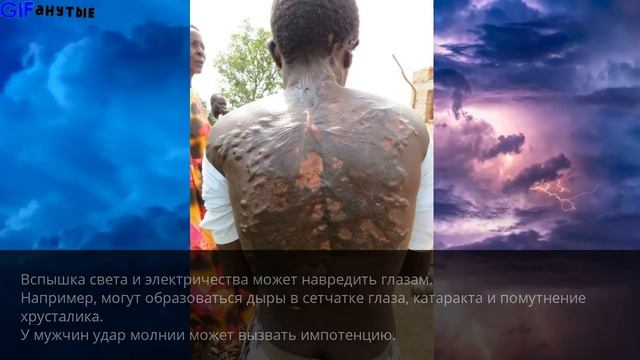 Последствия попадания молнии в человека смотреть онлайн