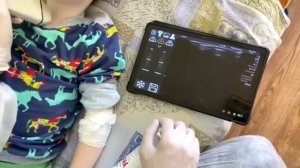 Ультразвуковая диагностика у детей ?? ??⚕️ ? Беспроводной УЗИ Delta 8