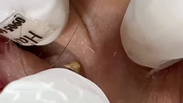 Enjoy Every Day With The Best Video Loan Nguyen Spa Official |  1421