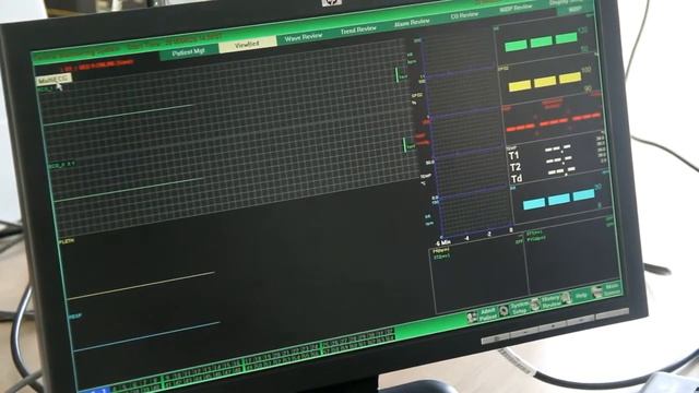 CONTEC Central monitor system training video смотреть онлайн