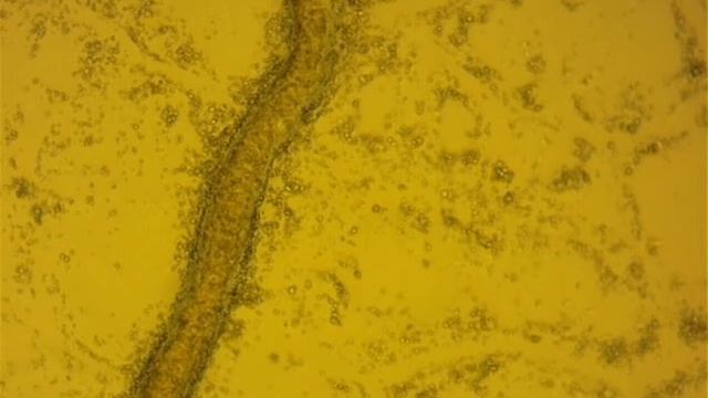 Cytoplasmic streaming in Physarum sp., Myxomycota смотреть онлайн