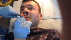 Вытаскивают с носа метровые тампоны. Жесть!  Pull out from the nose meter tampons