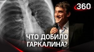 От чего на самом деле умер Валерий Гаркалин. Был ли шанс на спасение?