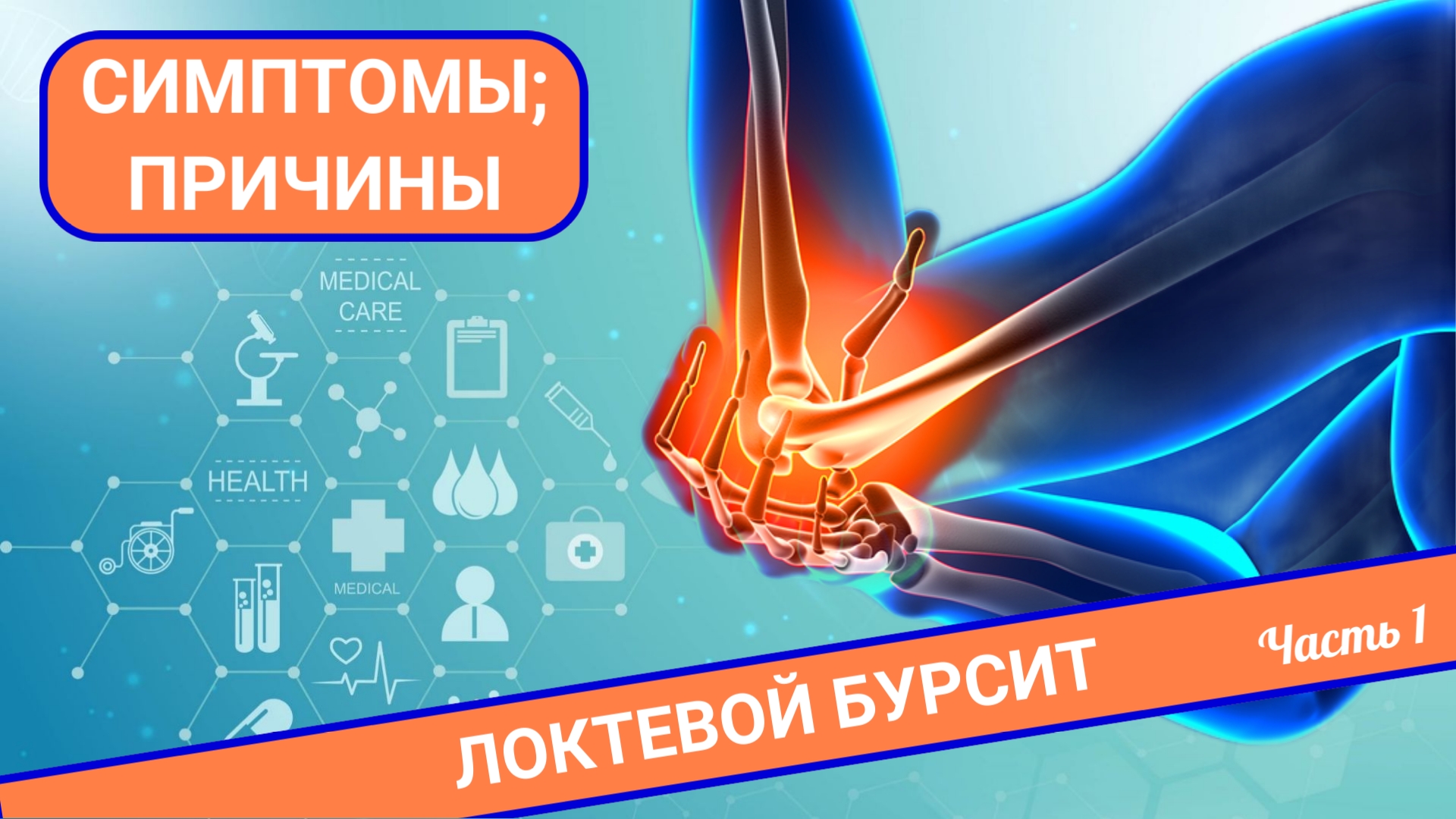ПРИЧИНЫ БОЛИ В ЛОКТЕ | Локтевой бурсит (Часть 1) смотреть онлайн