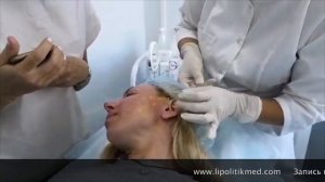 Постановка мезонитей COG