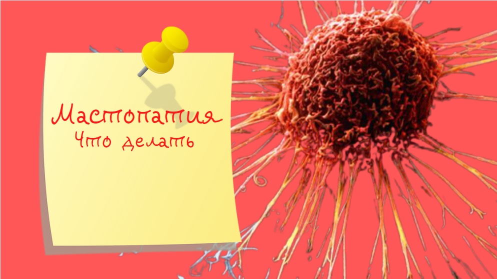 Мастопатия | Что с этим делать