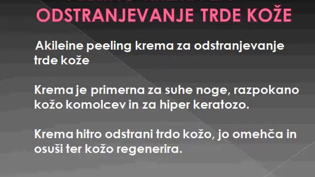 akileine prezentacija1 смотреть онлайн