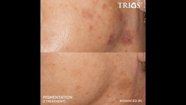 Viora Trios смотреть онлайн