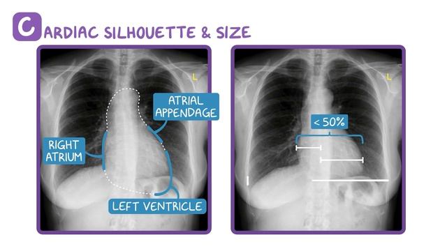 Reading a chest X-ray смотреть онлайн