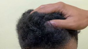 Царапины от перхоти большими хлопьями ( Big Flakes ) #648