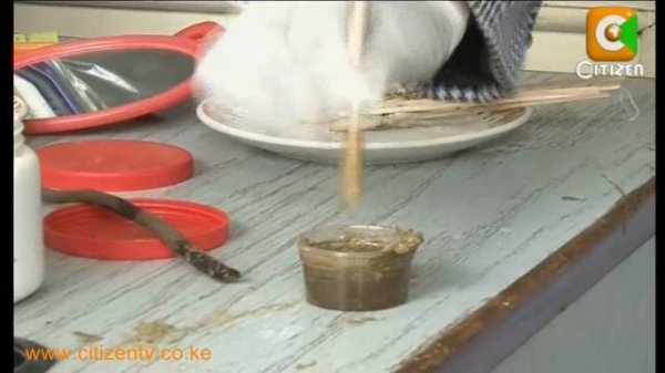 Cleaning Brown Teeth