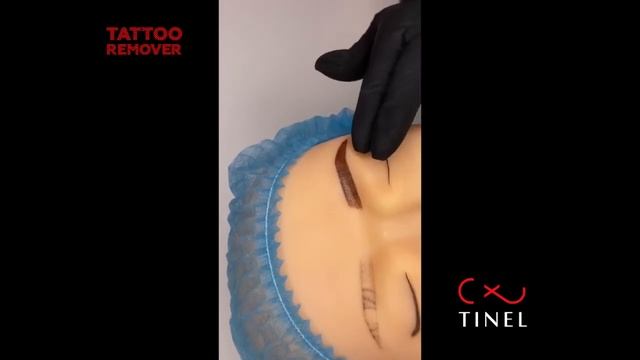 Ремувер TINEL удаление татуажа (часть 4) смотреть онлайн