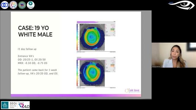 Pros and Cons of the Different #MyopiaManagementTherapies | OOLS | Dr. Glenda Aleman-Moheeputh смотреть онлайн