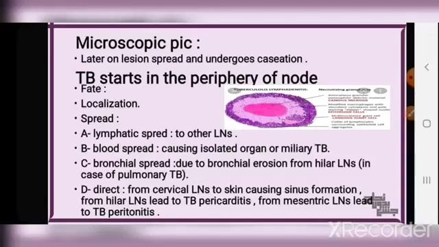 Revision of L1 , Non neoplastic lymph node enlargement, Pathology смотреть онлайн