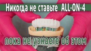 All-on-4 или ВСЕ-на-ЧЕТЫРЁХ. Рассматриваем наглядно отличия двух вариантов протезов.