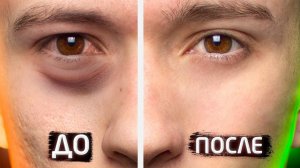 Как быстро убрать МЕШКИ И ОТЁКИ ПОД ГЛАЗАМИ на лице (САМЫЕ РАБОТАЮЩИЕ УПРАЖНЕНИЯ)