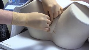 Акушерский пессария Арабин Введение пессария