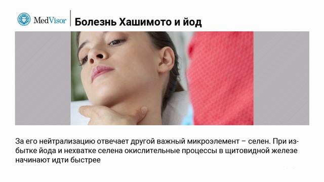 Аутоиммунный тиреоидит (Болезнь Хашимото): как он связан с приемом йода? смотреть онлайн