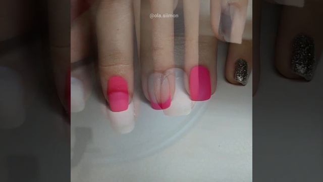 Как выровнять ноготь растущий в бок