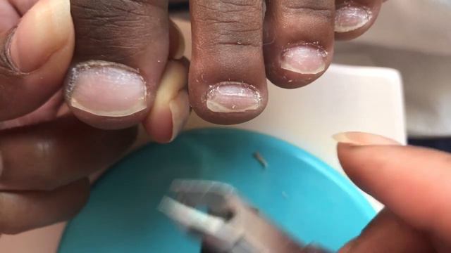 How To Perform Super Easy Pedicure for a Kid: Spa Day Ideas, Cheap Pedi for all Ages, Foot Hygiene смотреть онлайн