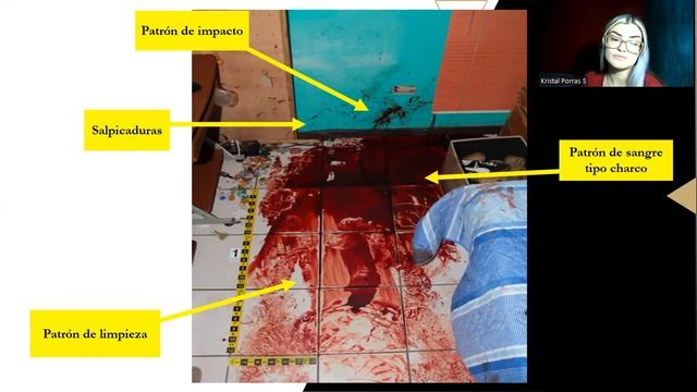 Análisis de morfología de manchas de sangre смотреть онлайн