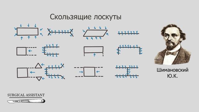 Кожная пластика на свиной ножке смотреть онлайн
