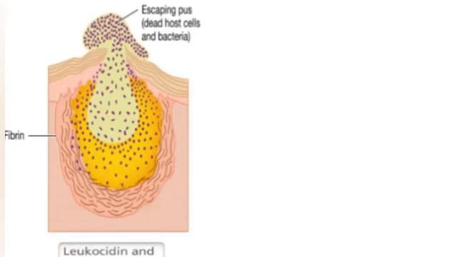 Staphylococcus II Pathogenicity II Clinical Significance II Diagnosis And Treatment