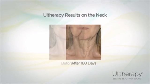 Oracle Ultherapy смотреть онлайн