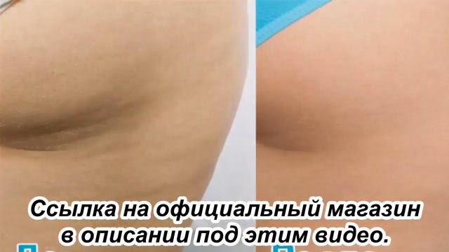 Антицеллюлитные ллегинсы FLEX смотреть онлайн