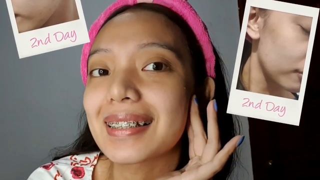 14-day experience with skinscape смотреть онлайн