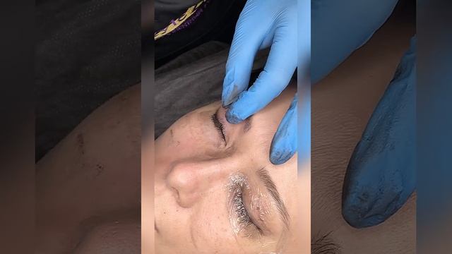 Веки. Процедура от и до.